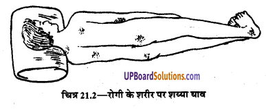 UP Board Solutions for Class 9 Home Science Chapter 21 रोगी का बिस्तर