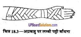UP Board Solutions for Class 9 Home Science Chapter 18 तिकोनी और लम्बी पट्टियाँ तथा उनका प्रयोग
