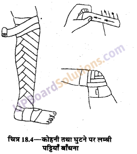 UP Board Solutions for Class 9 Home Science Chapter 18 तिकोनी और लम्बी पट्टियाँ तथा उनका प्रयोग